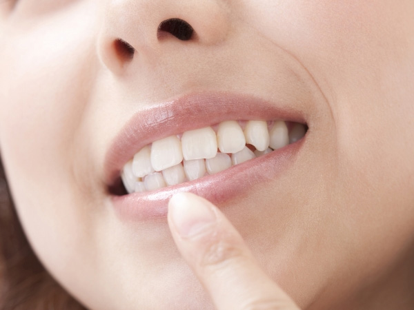 ホワイトニング