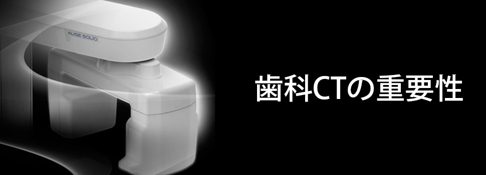 高性能3次元CT「AUGE SOLIO」
