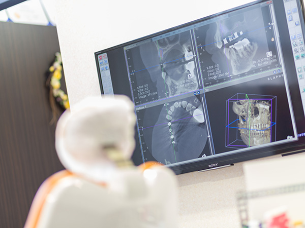 インプラント治療をするために診断・治療計画の説明