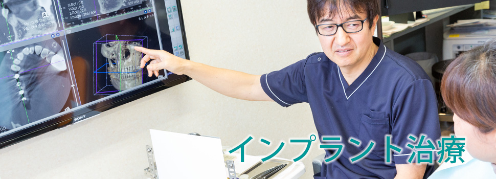 インプラント治療