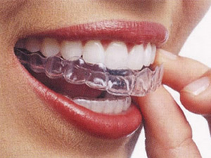 ホームホワイトニング